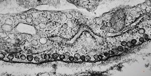 M,22y. | normal heart, endothel, pinocytosis